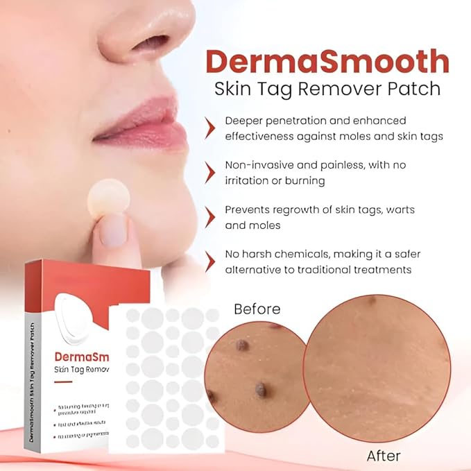 DermaSmooth Skin Tag Remover Patch (Pack of 2)